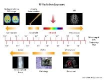 RF radiation exposure / © ASRT