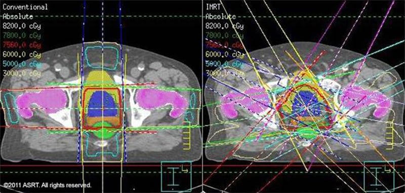 Radiation Therapy / Image © ASRT