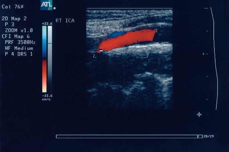 Sonograph image / Image © ASRT