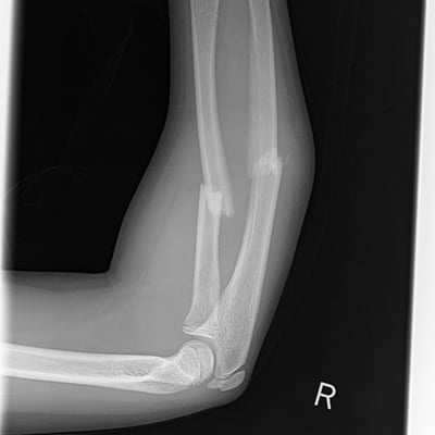 Trauma Radiography