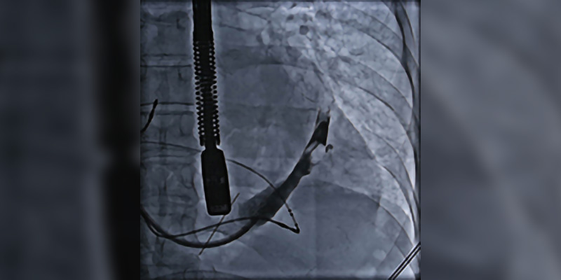 Cardiac-Interventional Radiography Bundle