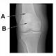 HumanSkeletalAnatomy_ModuleFour