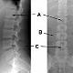 HumanSkeletalAnatomy_ModuleSix