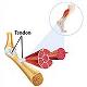SevereTraumatoExtremities