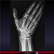 Ziltron_RadiographySimulators